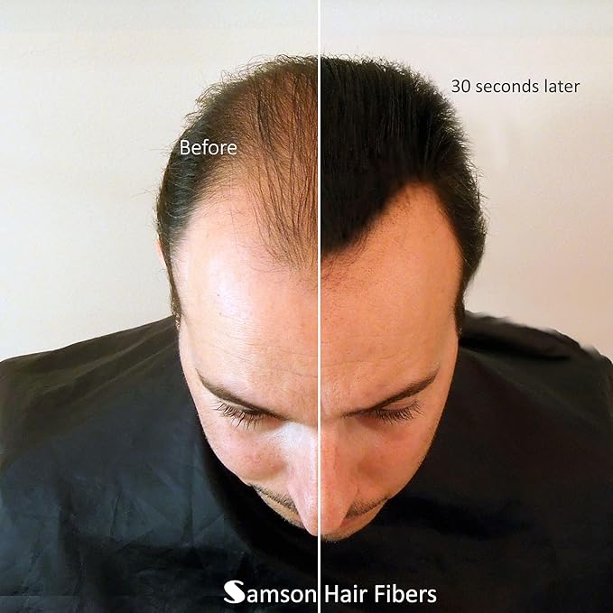 Hair Building Fibers, 28g - for Thinning Hair Instantly Thicker, Complete Looking Hair 6 Shades for Men Women (Black)