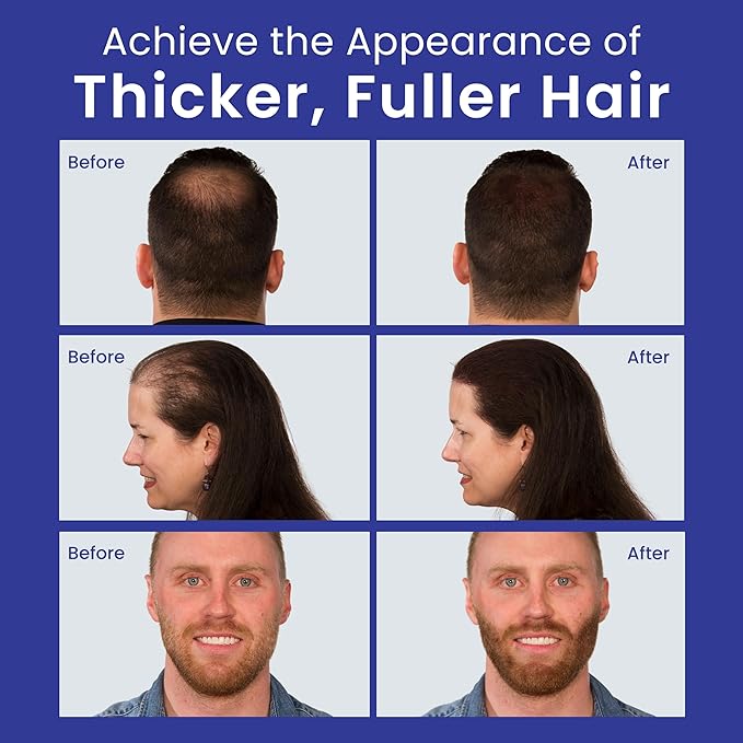 INFINITY Hair Fibers Dark Brown for Thinning Hair for Women & Men - 100% Undetectable Hair Building Fiber Powder - Conceal Hair Loss in 15 Seconds, 15g