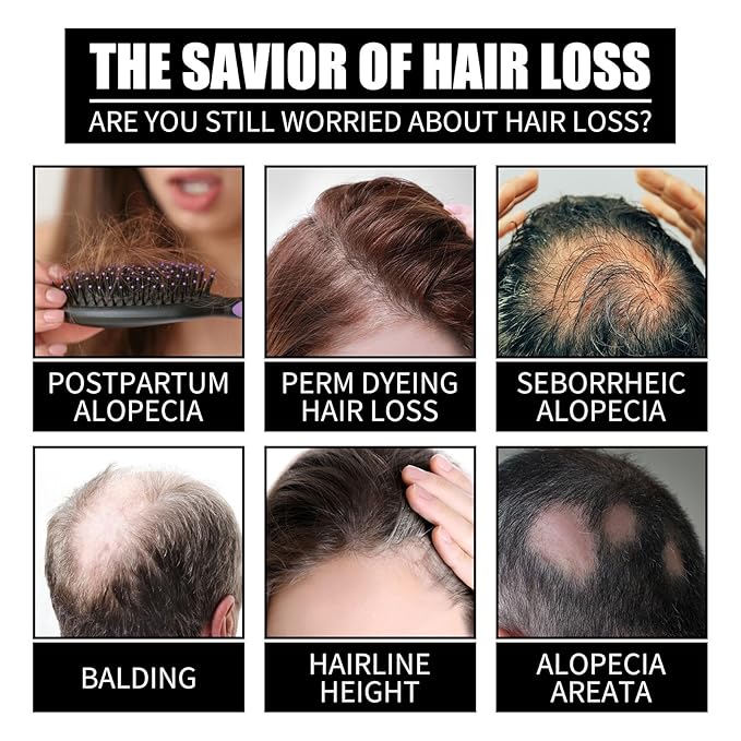 Hair Care Oil with Biotin and Collagen, Scalp Nourishing Treatment for Hair Loss Prevention and Root Strengthening, Suitable for Men and Women