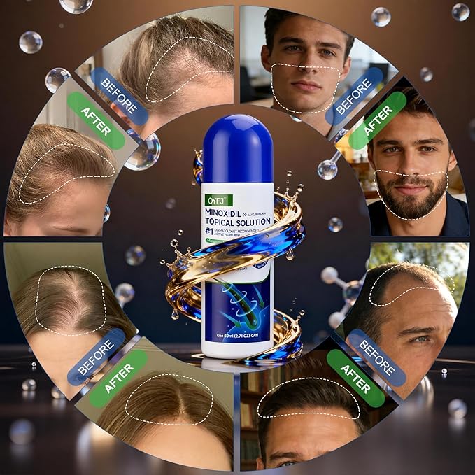 3 Pack 5% Minoxidil for Men and Women,Minoxidil Beard and Hair Growth Serum(Biotin-Infused) with Sponge Applicator for Thinning Hair and Sparse Beards,4-Month Supply 3 x 2.7 FL OZ
