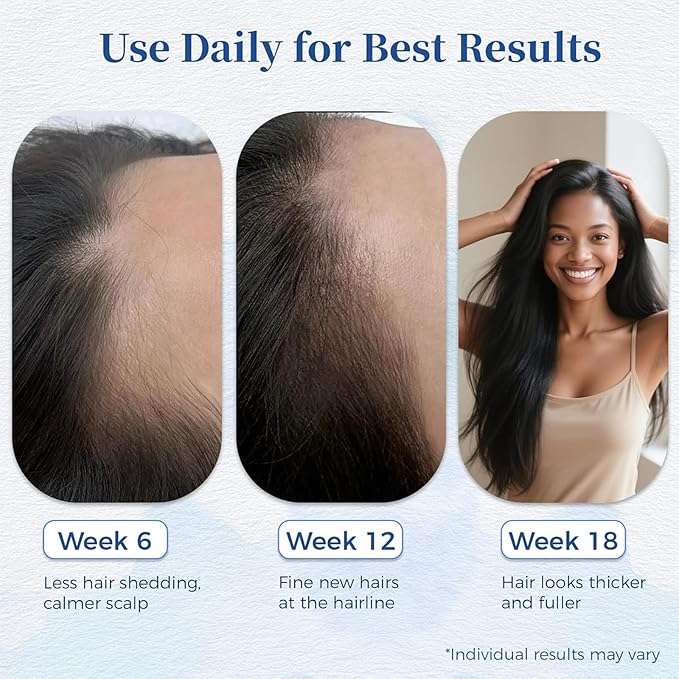 Aparthy Advanced Hair Growth Roll-On Serum，with Saw Palmetto, Rosemary & Pea Extract，Helps Support Thicker, Fuller Hair Appearance，Clean, Non-Greasy Hair Loss Support for Men & Women Pack of 25ml (1)
