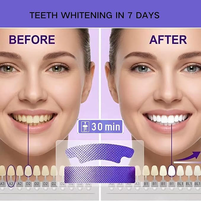 Teeth Whitening Strips, Purple Whitening Strips for Sensitive Teeth, Enamel Safe, Fast Acting for Removing Coffee,Smoking Stains, 7 Days for Smile Effective Gentle Dental Whitener (14Strips, Mint)