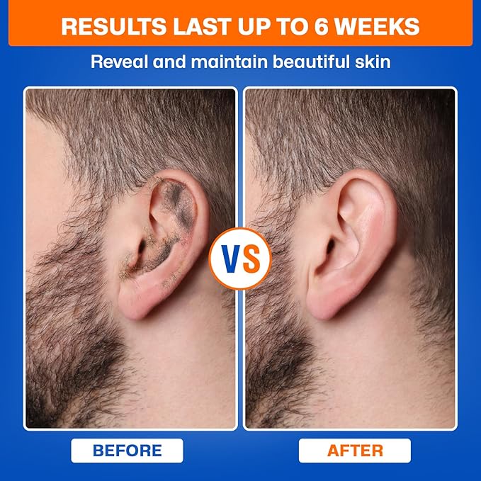 2-in-1 Ear & Nose Waxing Kit for Men & Women | 100g Hair Removal Wax + 99pc | 20 Applicators, 10 Nasal Sticks, 15 Wipes & 20 Earplugs | No Microwave Needed | Nose Wax Kit, Ear Hair Remover