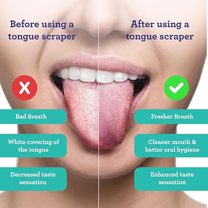 GuruNanda Tongue Scraper for Adults (4 Pack) with Travel Case, 420 Medical-Grade 100% Stainless Steel Tongue Cleaner, Aids in Fresh Breath & Oral Care