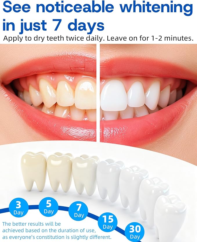 Teeth Whitening Pen, 35% Carbamide Peroxide Gel, Tooth Paint & Teeth Whitening Gel as Effective Tooth Whitener, Removes Tough Stains Coffee, Wine, Tea, Sensitive Teeth-Friendly, Travel-Portable(4 Pcs)