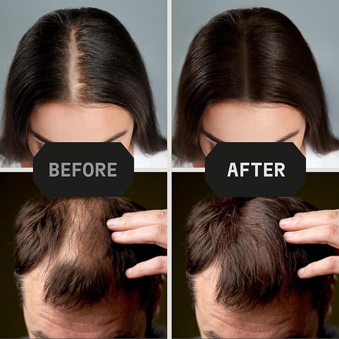 Striking Viking Hair Building Fibers - 28g, Black - Fuller Look Thinning Hair Fibers - Bald Spot Concealer & Barber Enhancement - Clump-Proof Powder & Hold Spray