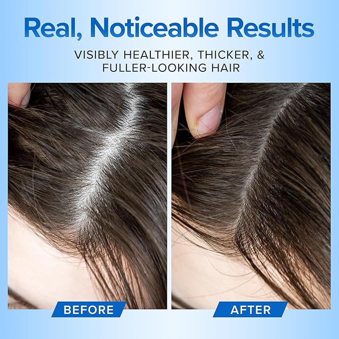 Hair Growth Shampoo for Thining and Hair Loss - Sulfate Free for Men and Women - Shinier, Volumizing and Thickening Shampoo for Color Treated Hair with Aloe Vera (16oz)