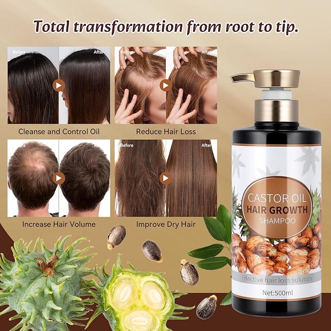 Silvercell Castor Oil Shampoo for Hair Growth, Prevents Hair Loss, Strengthens Hair Roots, Nourishes Dry Hair, Thickening Shampoo for Women & Men, 16.91 fl.oz, Beige