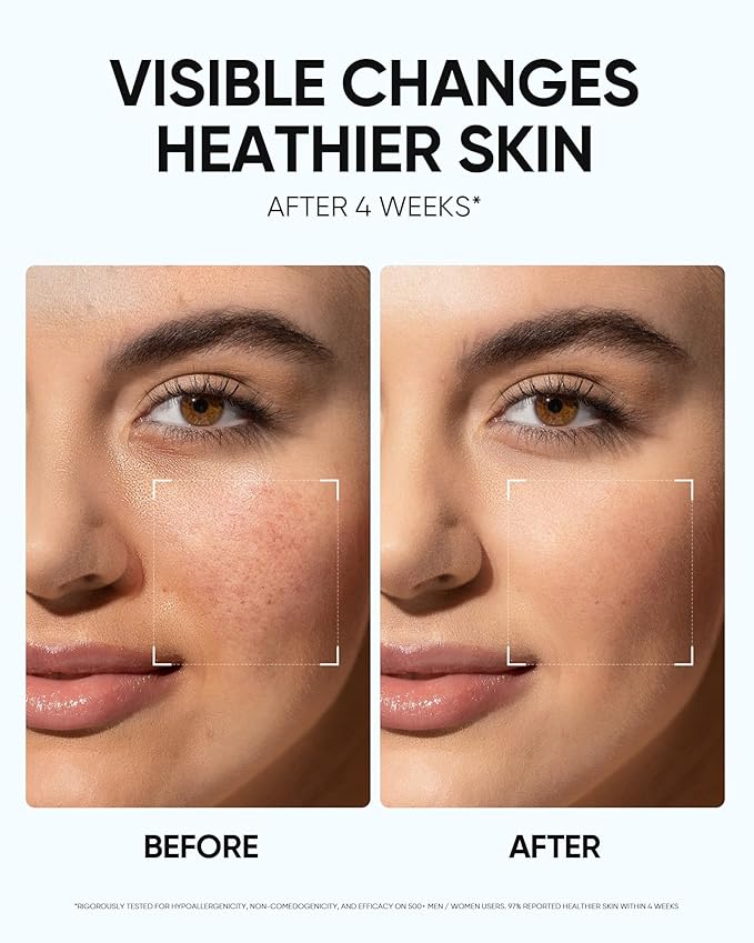 Face Moisturizer with 5X Ceramides, Hydrating Moisture Barrier Repair Cream for Sensitive/Oil Skin Types, Hyaluronic Acid & Centella, Daily Facial Moisturizer, Non-Comedogenic 100g/3.53fl.oz