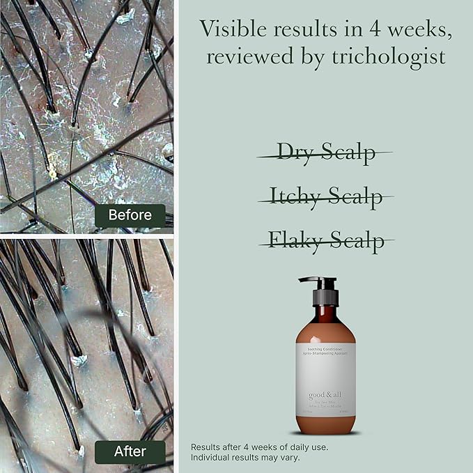 GOOD&ALL Tea Tree Conditioner for Dry Itchy Scalp with Peppermint - Sulfate/Sulphate, Silicone, Paraben, Fragrance Free - Anti Frizz - 13.5 fl oz