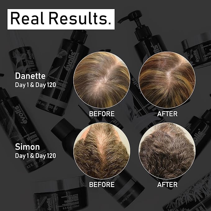 EVOLIS Reverse Thickening Shampoo for Fuller-Looking Hair - Keratin Treatment & Formula for Thinning Hair - Travel Size (2 fl oz)