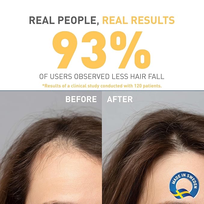 Organica Anti-Hair Loss Shampoo for Normal Hair, Dermatologically and Clinically Tested, Restores Hair Vitality, Boost Hair Growth with BioTrust Technology, 300 Ml