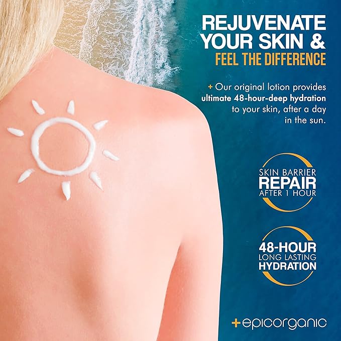 After Sun Lotion | Sunburn Relief | Aloe Vera & Vitamin E Cream | Body Lotion & Face Moisturizer | Lotion for Dry Skin | Itchy Skin Relief | Moisturizer Face Cream | 8 oz