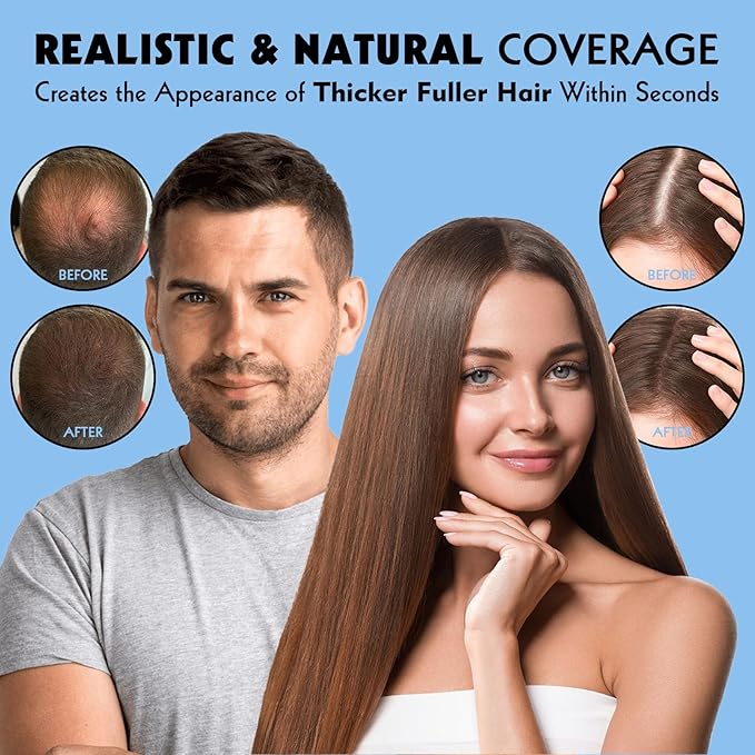 Hair Fibers for Thinning Hair - Hair Building Fibers for the Appearance of Thicker, Fuller Hair, Hair Thickening Fibers for Men and Women - Easy to Apply & Remove, 27.5g/ 0.97oz (Auburn)