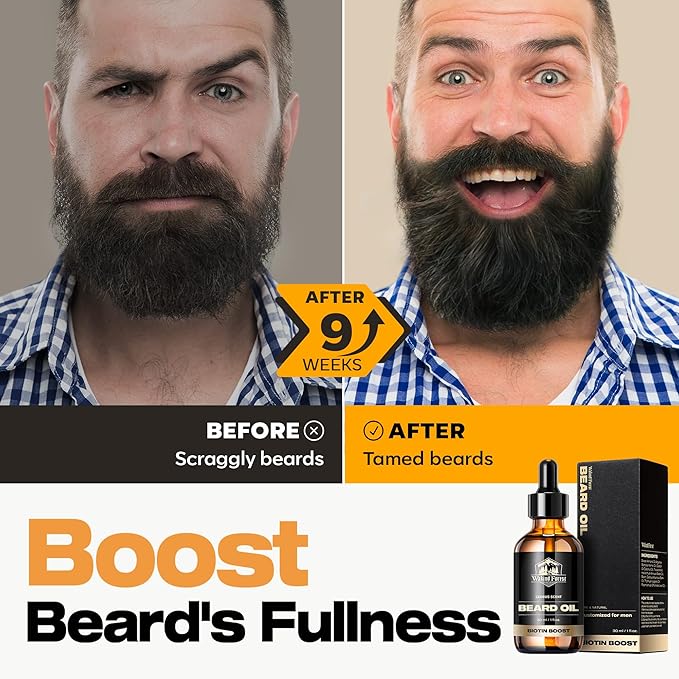 Waking Forest Cedar Beard Oil for Men - Biotin Mustache Oil with Vitamin E, Rosemary & Castor - Beard Care Softener, Strengthens, and Moisturizes - Beard Conditioner (1 oz)