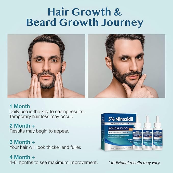 5% Minoxidil Hair Growth for Men and Women: Extra Strength Beard Regrowth Treatment Serum with Minoxidil and Biotin for Thinning Hair Loss to Grow Thicker Fuller 60ml 3 Bottles