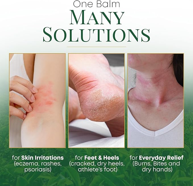 Tea Tree Oil Balm- All Natural | Great Cream for Soothing Eczema, Cracked Foot, Rashes, Jock Itch, Bug Bites, Folliculitis, Acne, Itchy Skin, Cuticles, Psoriasis, Saddle Sores- For Women & Men, 2-Pack