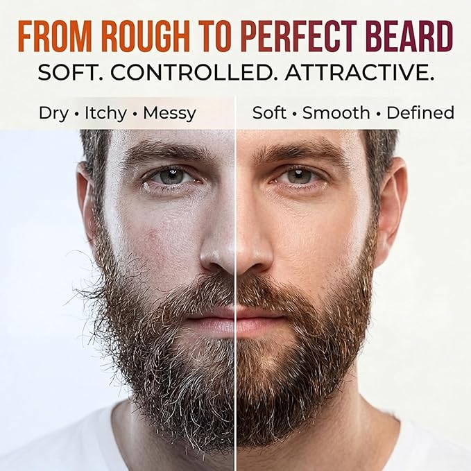 Biotin Beard Conditioner & Softener for Men – with Aloe Vera & Collagen, Moisturizing Cream for Coarse Dry Hair, Beard and Skin – Sandalwood Scent Care Leave In Conditioner Alternative (5 Fl Oz)