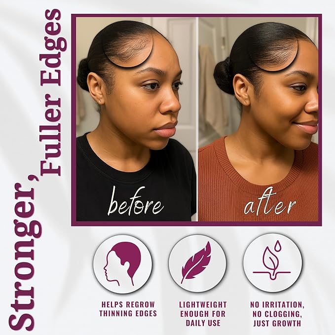 Dr. Sebi Batana Oil for Hair Growth, 100% Pure Raw & Unrefined from Honduras, Aceite de Batana Hair Growth Oil for 4C Hair - Edges, Scalp, Length