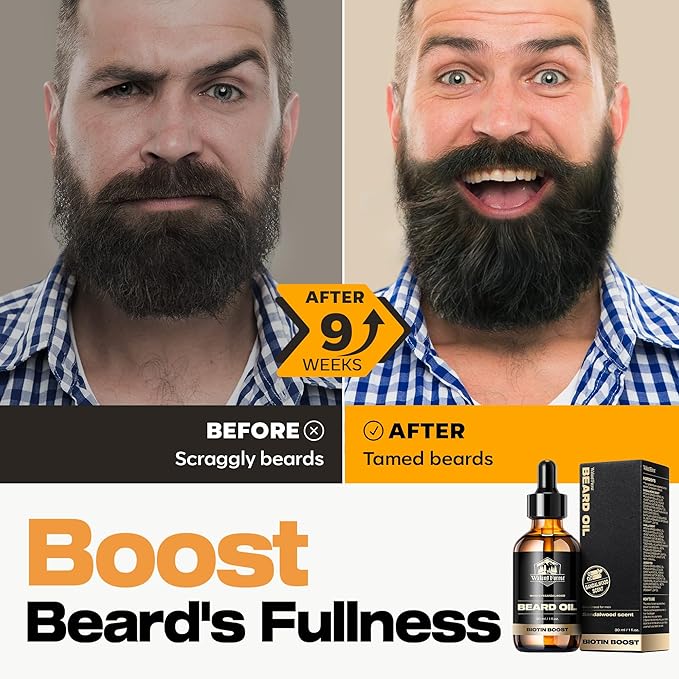 Waking Forest Sandalwood & Whiskey Beard Oil for Men - Biotin Mustache Oil with Vitamin E, Rosemary & Castor - Beard Care Softener, Strengthens, and Moisturizes - Beard Conditioner (2 oz)