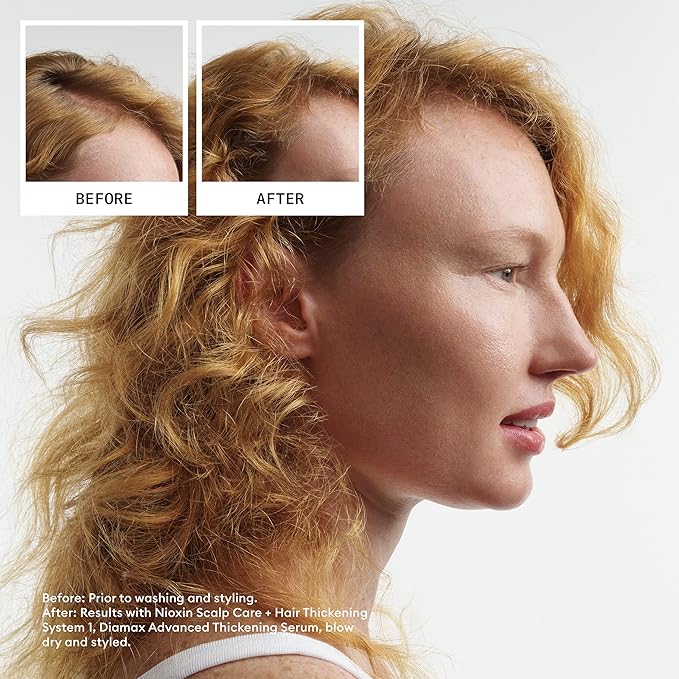 Nioxin Scalp + Hair Thickening System 1 Shampoo| For Natural or Untreated Hair with Light Thinning | With Niacinamide and Biotin | 16.9 Fl oz.