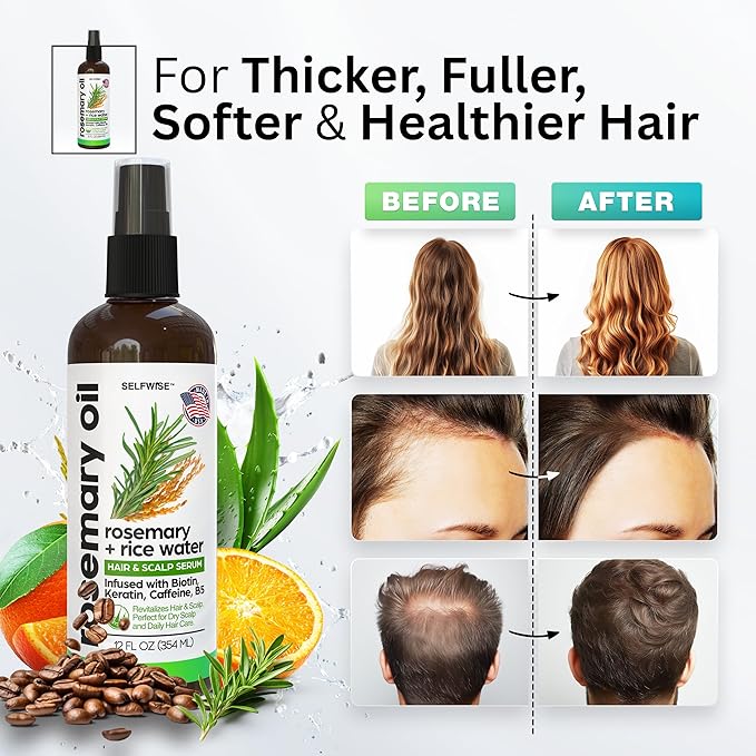 Rosemary Oil and Rice Water Hair Growth Spray - Serum with Biotin, Keratin, Caffeine, Vitamins C & B5 for Hair Mask, Hair Care, Scalp Treatment, Thickening Dry Damaged Hair for Women & Men 12oz