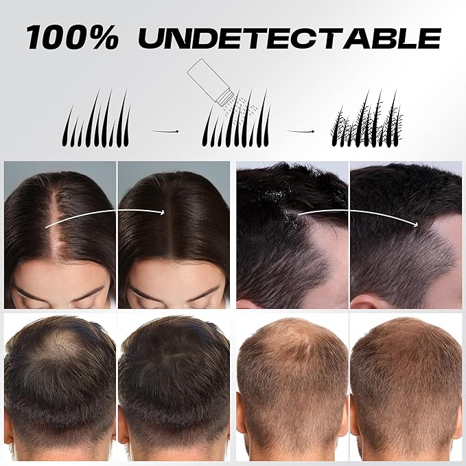 Hair Thickening Fibers for Thinning Hairline - 28g Fill In Fine or Thinning Hair - Instantly Thicker Looking - Waterproof Root Touch Up Hair Color Powder for Men & Women (Dark Brown)