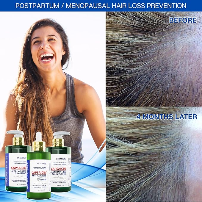 Botanical Capsaicin Shampoo for Hair Loss and Hair Thinning Oil-Free Scalp Stimulating Natural Shampoo For Men & Women 10.2 Fl Oz