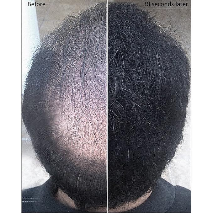 for Thinning Hair - 100% Undetectable Natural Formula - Completely Conceals Hair Loss in Seconds. Covers bald spots. Thicken your hair instantly - 25 Grams Refill (DARK GRAY)