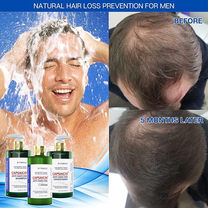 Botanical Capsaicin Shampoo for Hair Loss and Hair Thinning Oil-Free Scalp Stimulating Natural Shampoo For Men & Women 10.2 Fl Oz