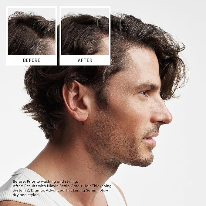 Nioxin Scalp + Hair Thickening System 2 Conditioner | For Natural or Untreated Hair with Progressed Thinning | With Niacinamide and Biotin |10.1 Fl oz.