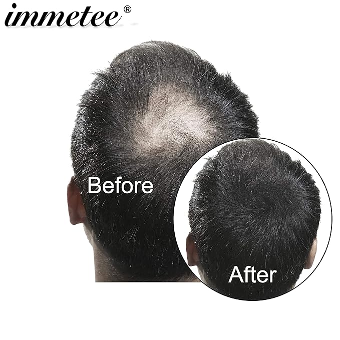immetee Hair Building Fibres Powder, Hair Fibres for Women & Men, 28g
