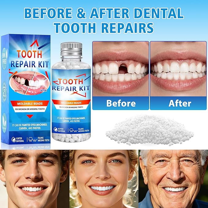 Tooth Repair Kit, Moldable False Teeth Beads, DIY Temporary Tooth Replacement Kit, Suitable for Missing, Broken and Chipped, Tooth Repair Beads Make You Smile Confidently-1PC