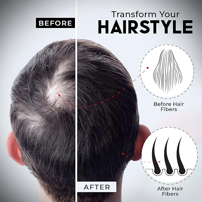 ELEVATE Hair Fibers to Instantly Thicken & Completely Conceal Thinning Balding Areas Loss in 30 Seconds for Men & Women (BLACK) 28g Size - 100% Natural & Undetectable Keratin Fibers
