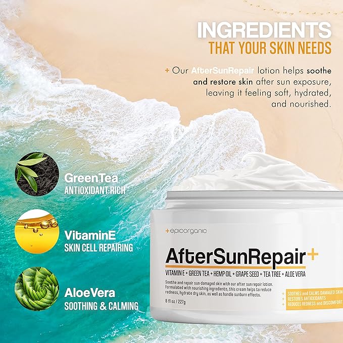 After Sun Lotion | Sunburn Relief | Aloe Vera & Vitamin E Cream | Body Lotion & Face Moisturizer | Lotion for Dry Skin | Itchy Skin Relief | Moisturizer Face Cream | 8 oz