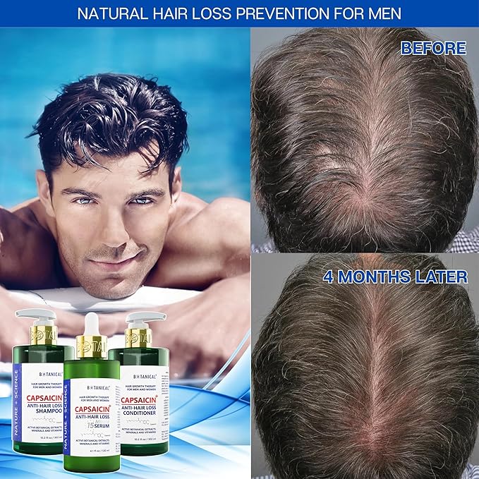 Botanical Capsaicin Shampoo for Hair Loss and Hair Thinning Oil-Free Scalp Stimulating Natural Shampoo For Men & Women 10.2 Fl Oz