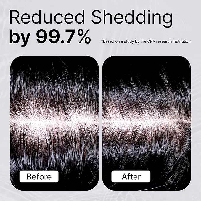 REFILLED Booster Plus Moisture | Hair Growth Serum & Thickening Scalp Treatment with Built-in Massager for Men & Women | Hair Loss & Thinning | Fuller & Baby Hair Regrowth | Fast-Absorbing with Biotin