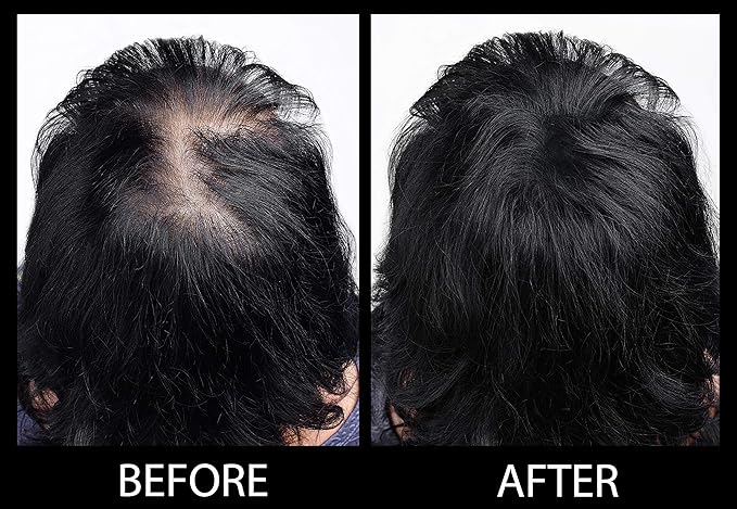 Volumizing Hair Fibers with real Keratin for Thinning Hair/Hair Loss – Dermatologist Tested and Certified Hypoallergenic - 60 days + supply - Multiple Colors Available (Gray)